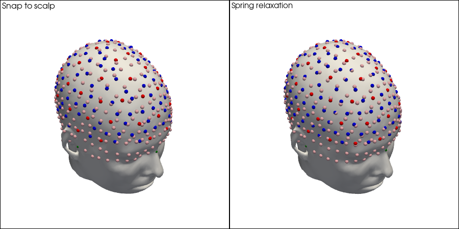 ../../_images/examples_head_models_51_spring_relaxation_registration_21_10.png