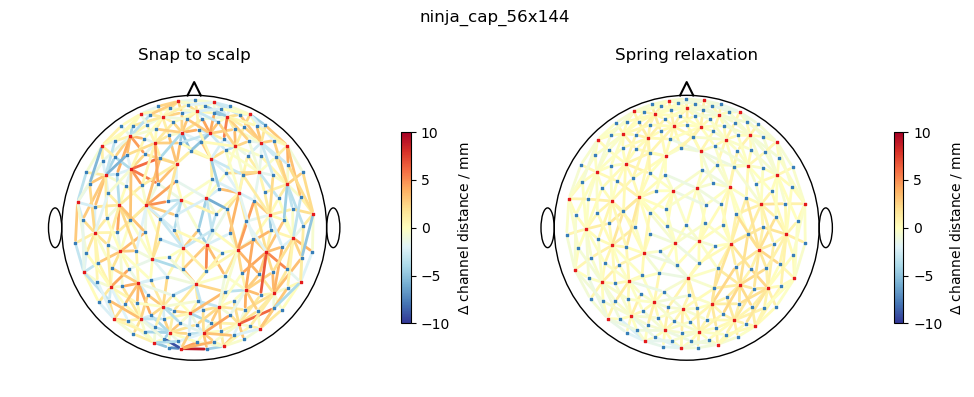 ../../_images/examples_head_models_51_spring_relaxation_registration_21_11.png