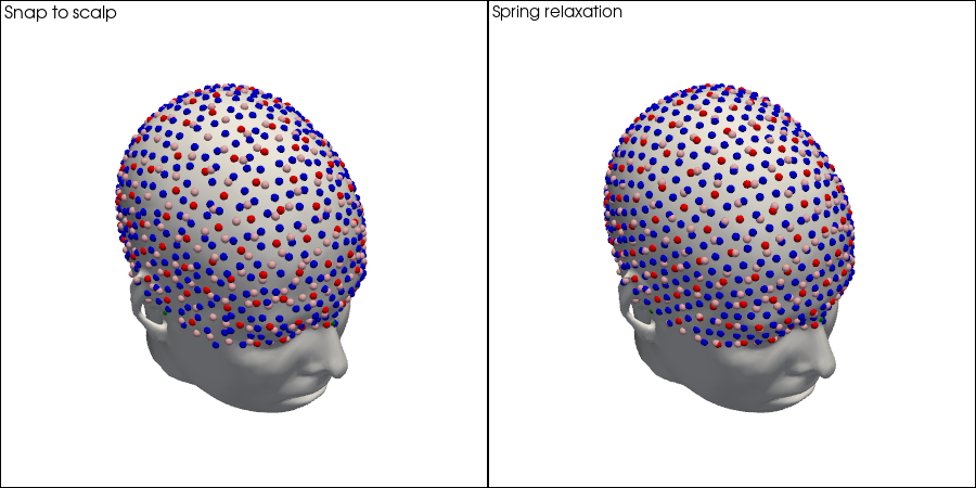 ../../_images/examples_head_models_51_spring_relaxation_registration_21_13.png