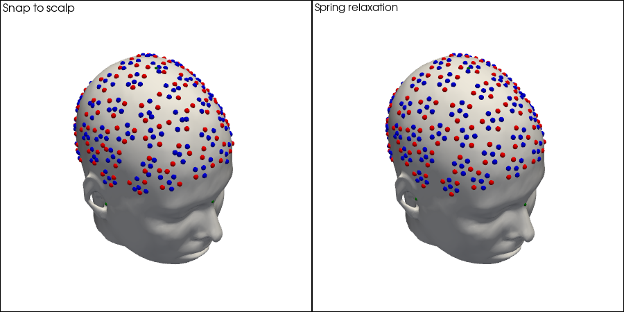 ../../_images/examples_head_models_51_spring_relaxation_registration_21_16.png