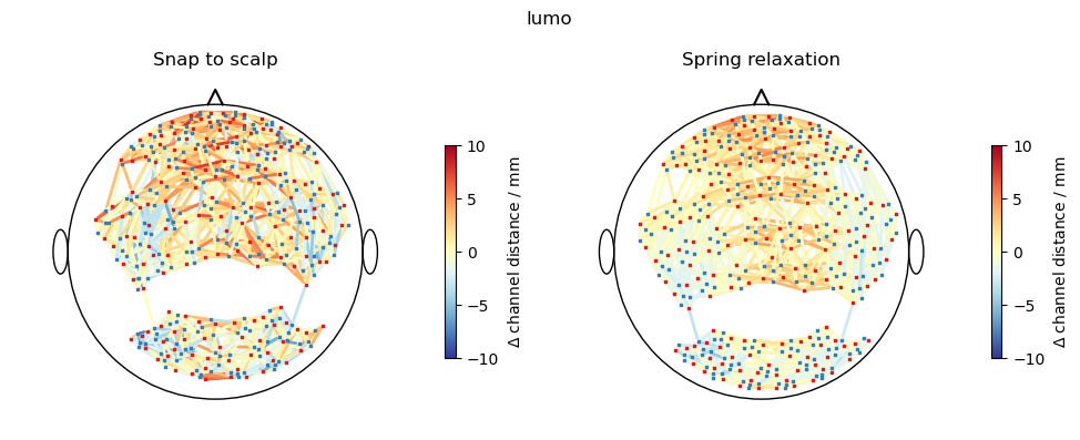../../_images/examples_head_models_51_spring_relaxation_registration_21_17.png
