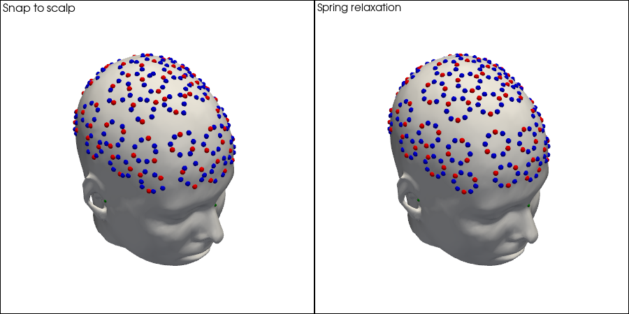 ../../_images/examples_head_models_51_spring_relaxation_registration_21_19.png