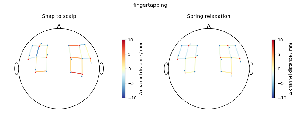 ../../_images/examples_head_models_51_spring_relaxation_registration_21_2.png