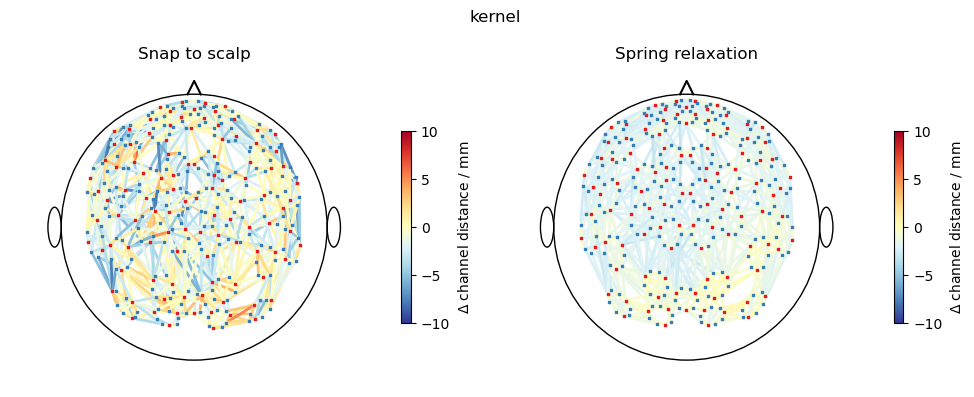 ../../_images/examples_head_models_51_spring_relaxation_registration_21_20.png