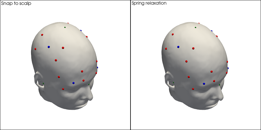 ../../_images/examples_head_models_51_spring_relaxation_registration_21_22.png