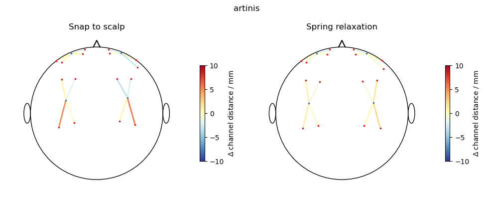 ../../_images/examples_head_models_51_spring_relaxation_registration_21_23.png