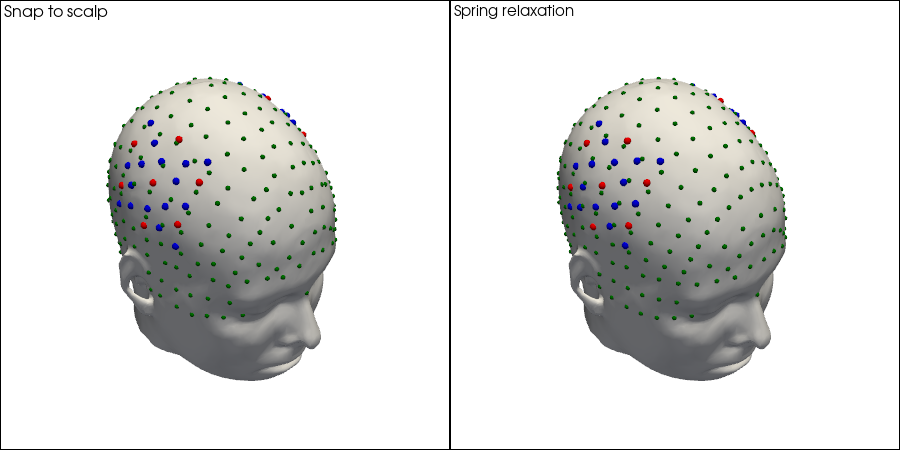 ../../_images/examples_head_models_51_spring_relaxation_registration_21_4.png