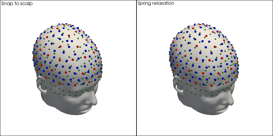 ../../_images/examples_head_models_51_spring_relaxation_registration_21_7.png