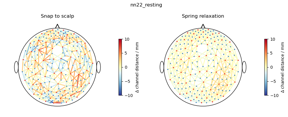 ../../_images/examples_head_models_51_spring_relaxation_registration_21_8.png
