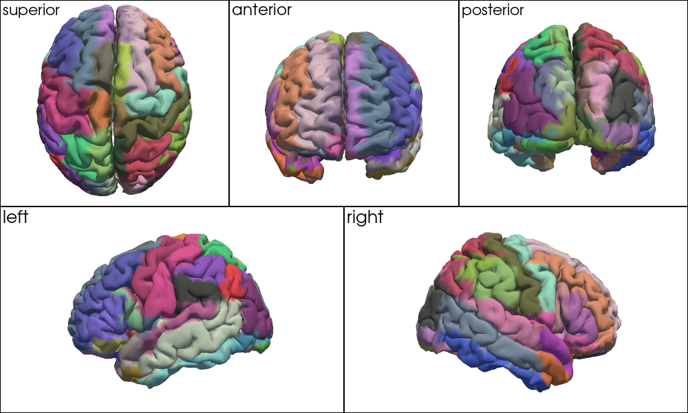 ../../_images/examples_head_models_52_mni_atlas_labels_aal3_brodmann_21_0.png