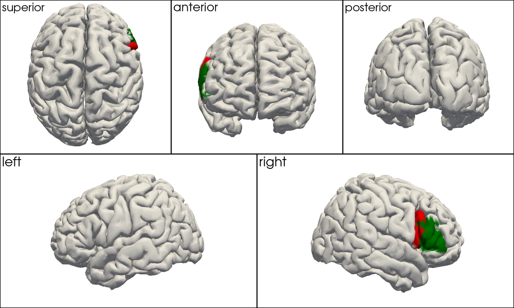 ../../_images/examples_head_models_52_mni_atlas_labels_aal3_brodmann_30_0.png