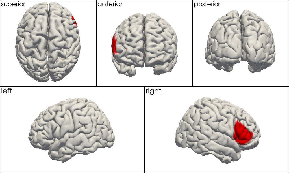 ../../_images/examples_head_models_52_mni_atlas_labels_aal3_brodmann_32_0.png