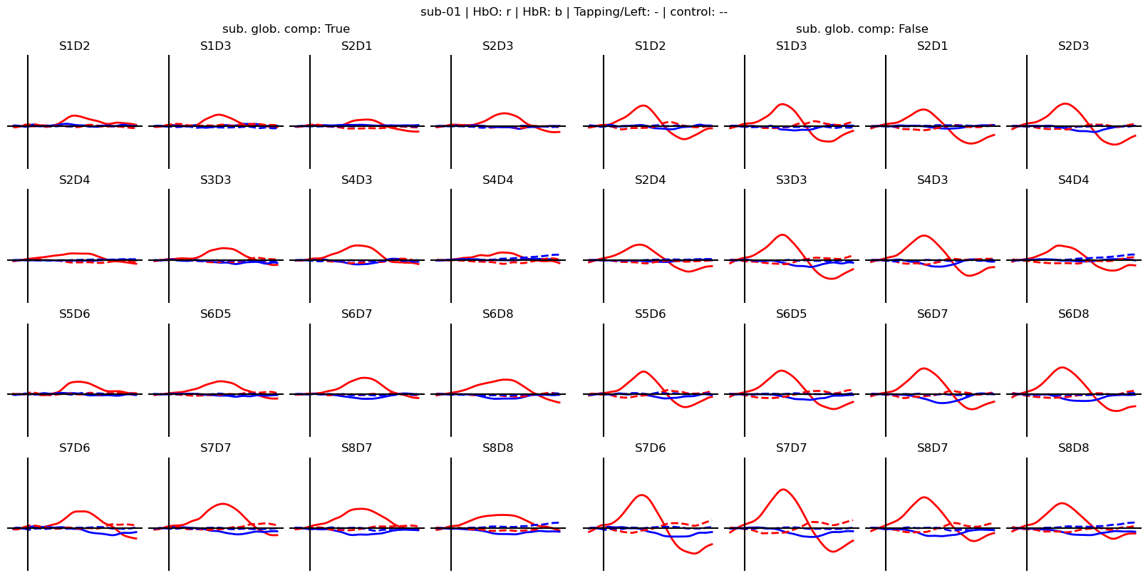 ../../_images/examples_machine_learning_50b_advanced_finger_tapping_lda_classification_20_1.png