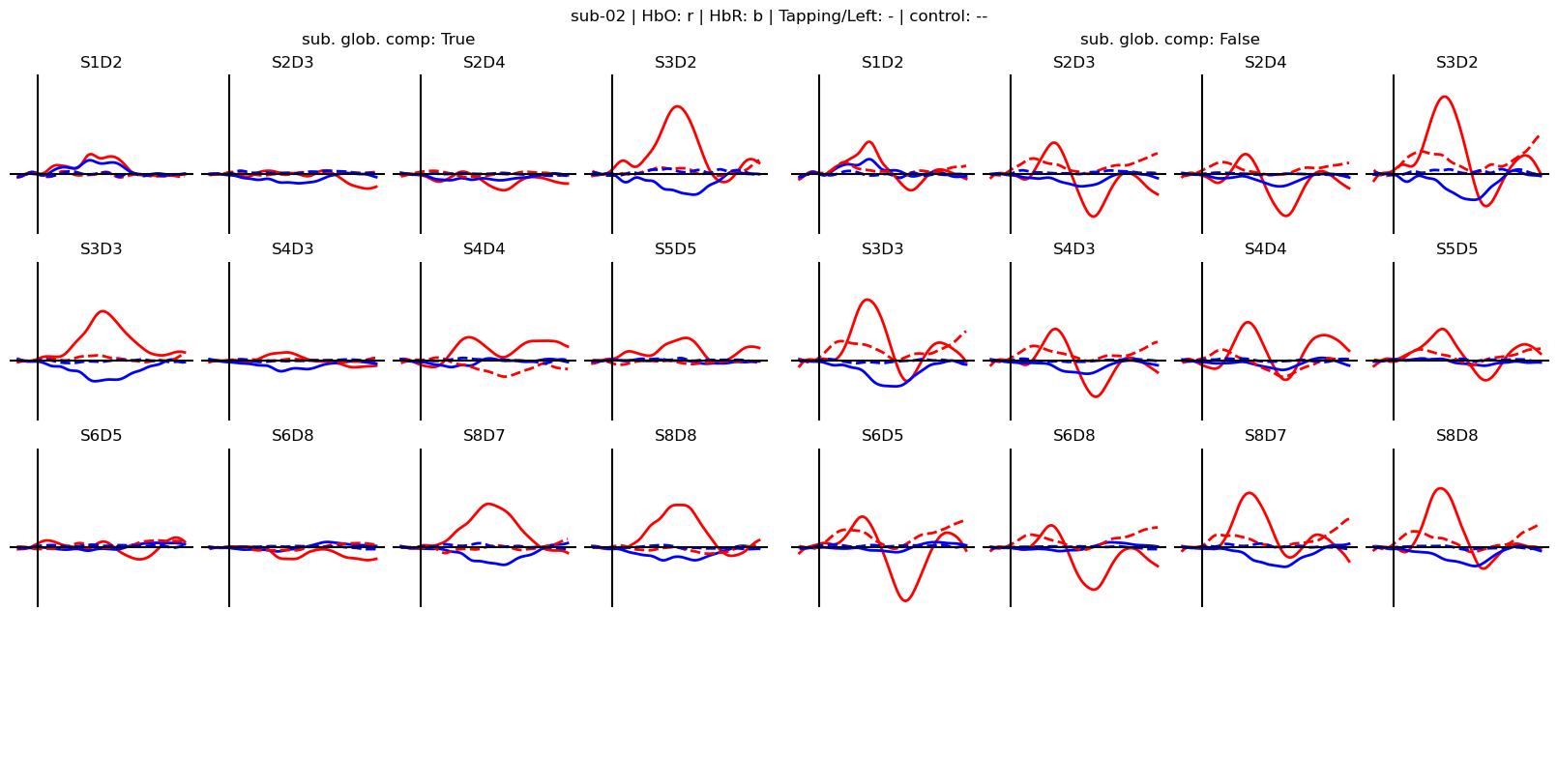 ../../_images/examples_machine_learning_50b_advanced_finger_tapping_lda_classification_20_2.png