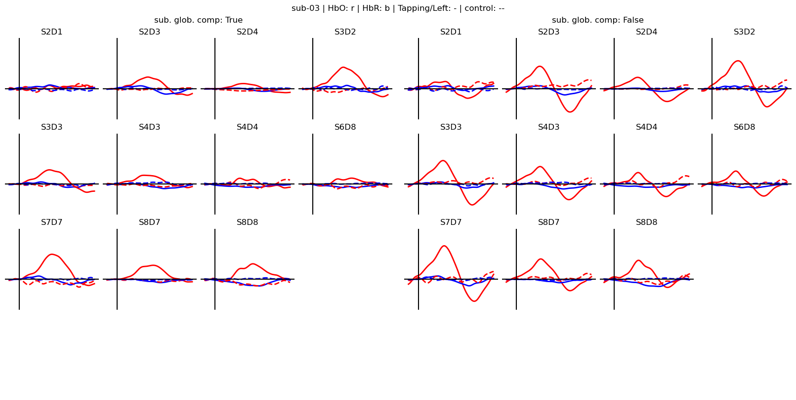 ../../_images/examples_machine_learning_50b_advanced_finger_tapping_lda_classification_20_3.png