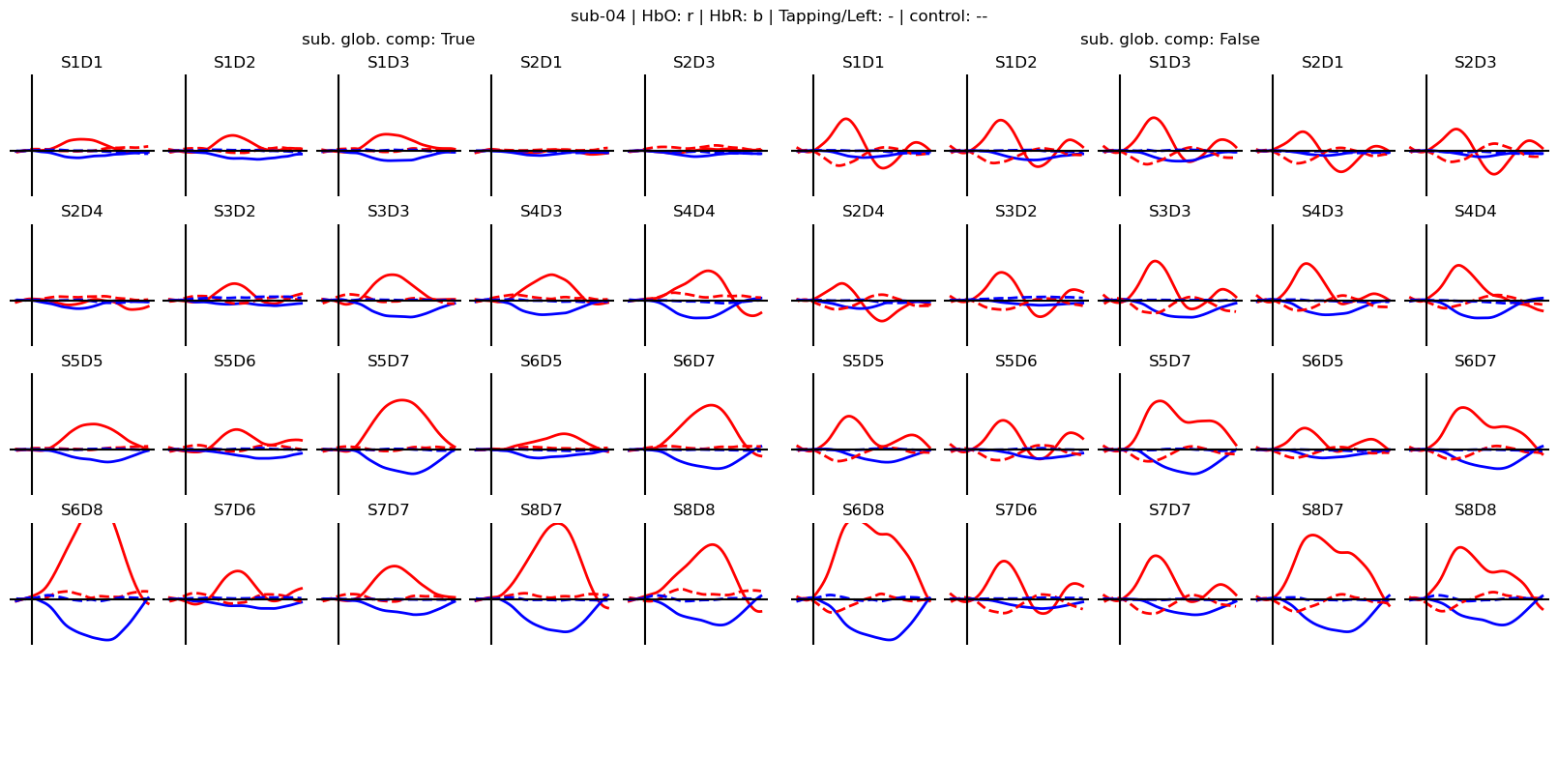 ../../_images/examples_machine_learning_50b_advanced_finger_tapping_lda_classification_20_4.png