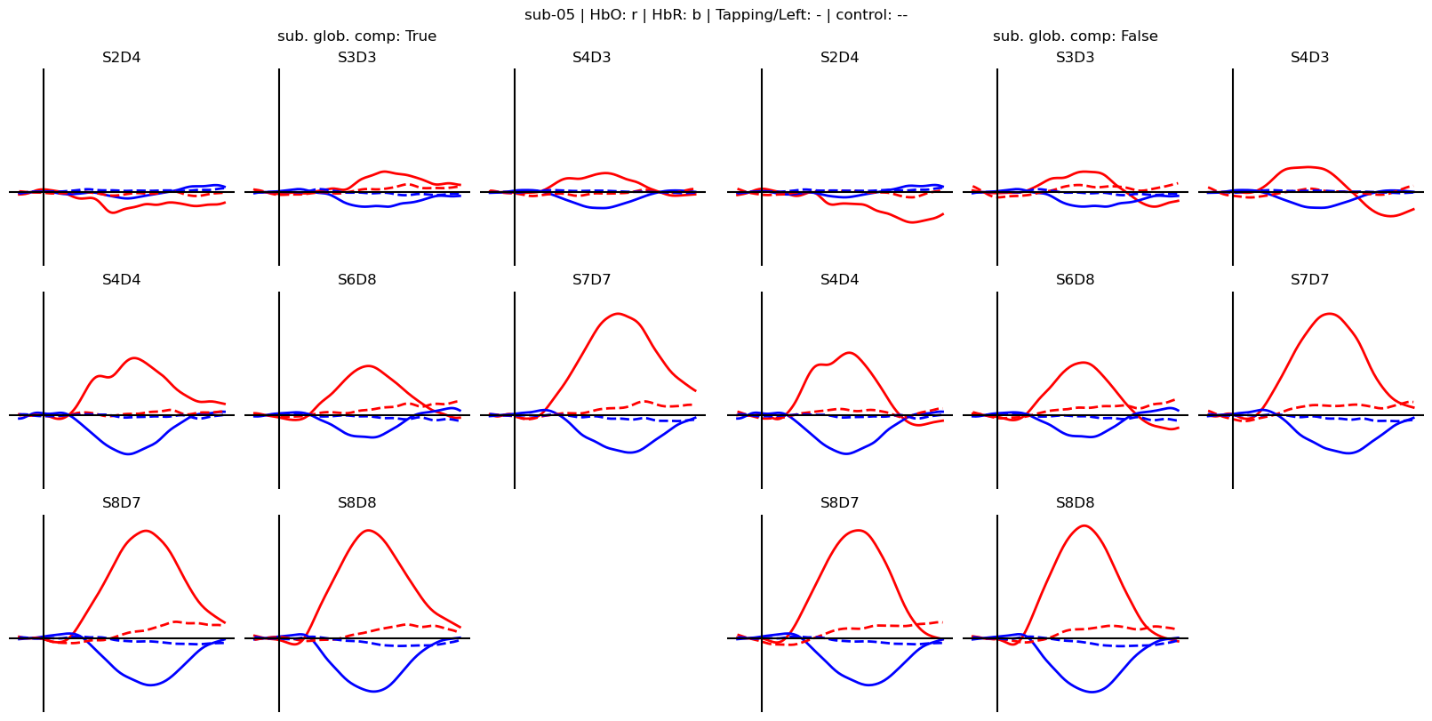 ../../_images/examples_machine_learning_50b_advanced_finger_tapping_lda_classification_20_5.png