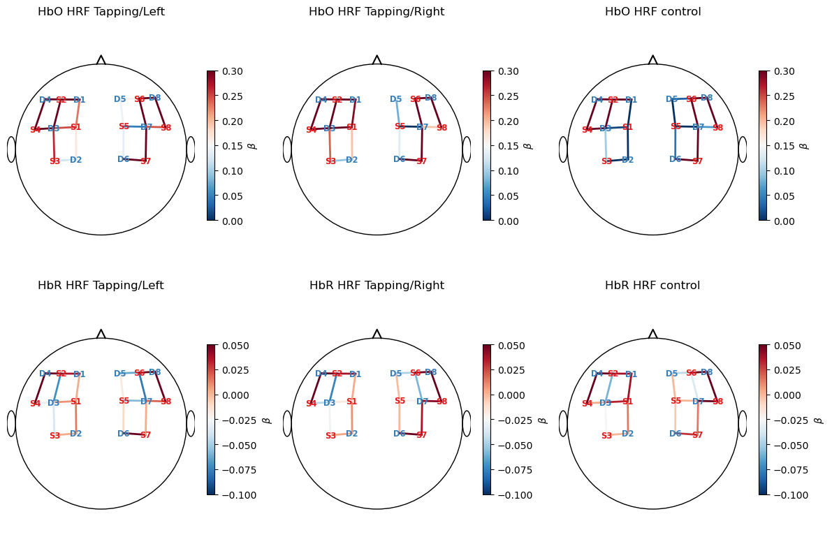 ../../_images/examples_modeling_32_glm_fingertapping_example_27_0.png