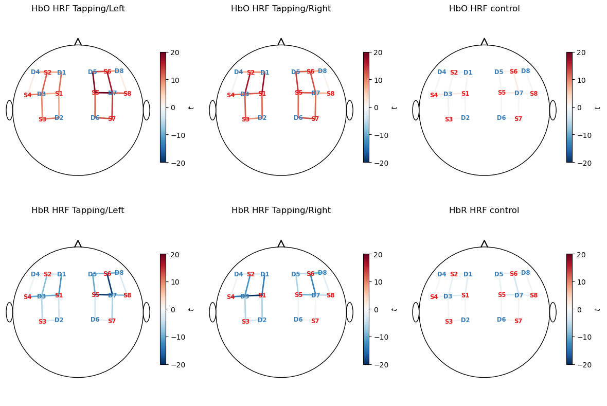 ../../_images/examples_modeling_32_glm_fingertapping_example_28_0.png