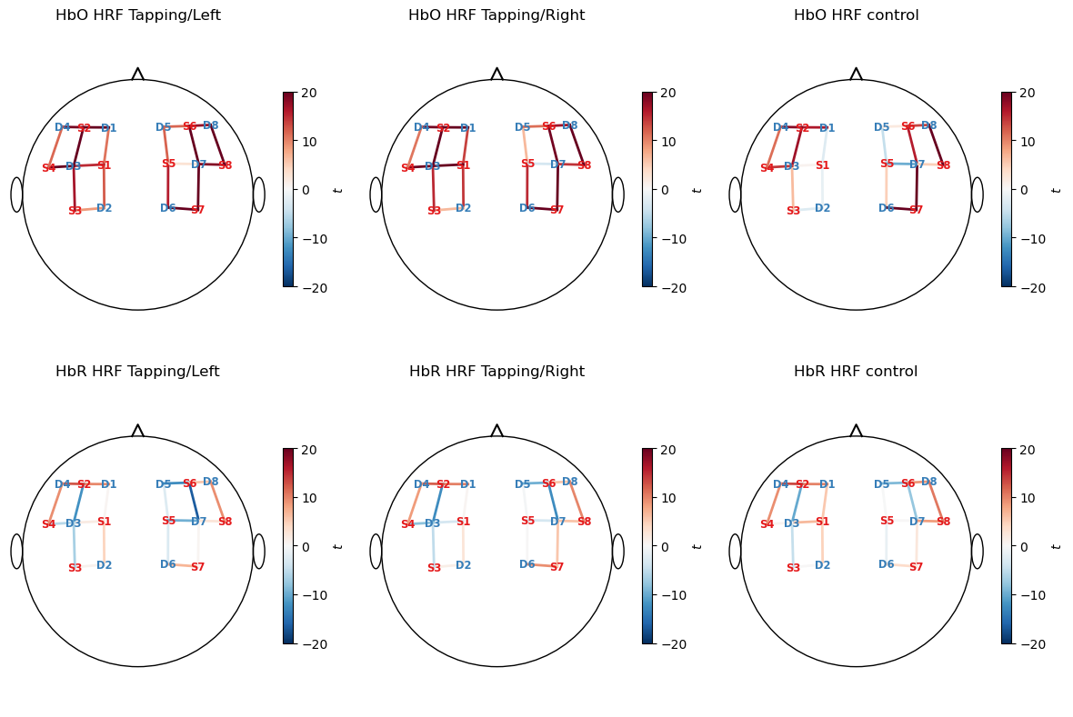 ../../_images/examples_modeling_32_glm_fingertapping_example_30_0.png
