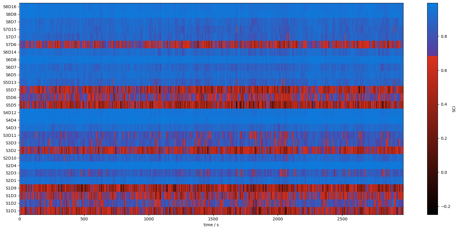 ../../_images/examples_signal_quality_20_scalp_coupling_index_19_1.png