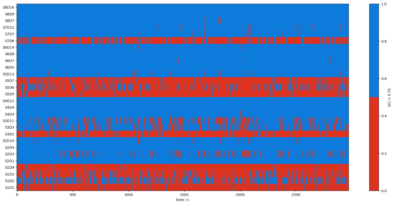 ../../_images/examples_signal_quality_20_scalp_coupling_index_19_2.png