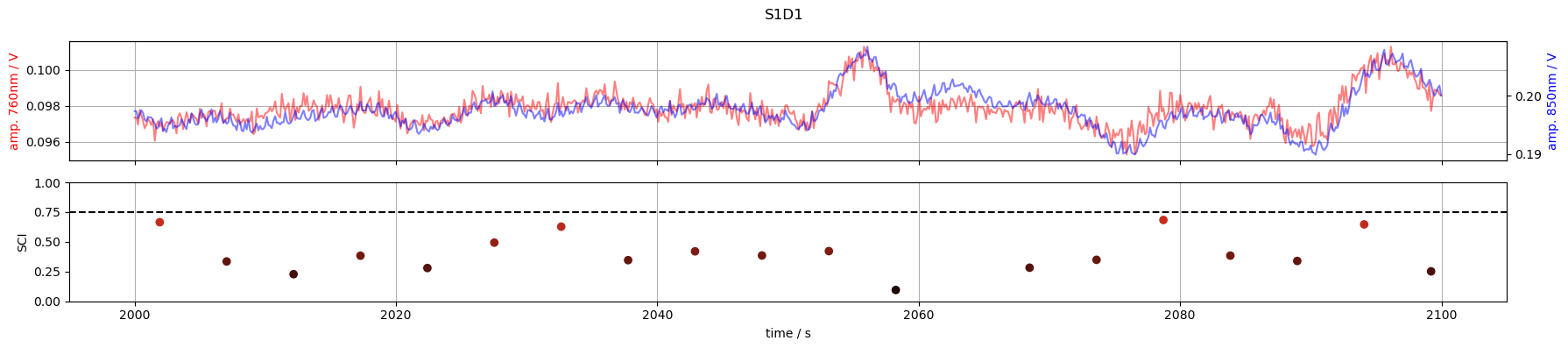 ../../_images/examples_signal_quality_20_scalp_coupling_index_21_1.png