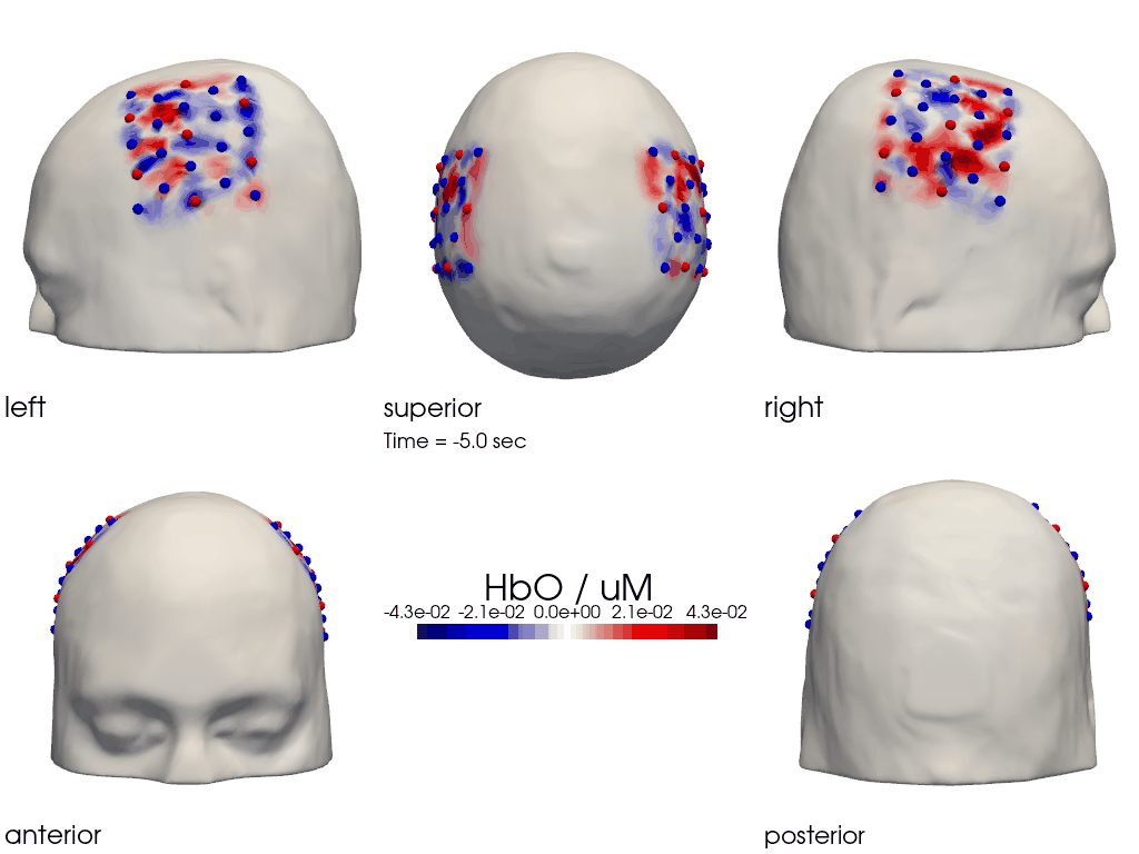 ../../_images/examples_tutorial_5_image_reconstruction_49_0.png